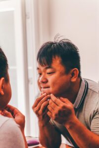 ニキビ跡のケアを自宅で行うための医療級対策は？
