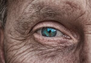 肌バリア改善のための医療級スキンケアはどれが効果的？