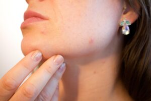 毛穴対策に最適な医薬部外品化粧水はどれですか？