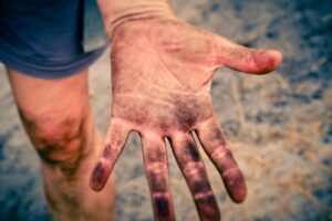 自宅で肌の水分量を上げるための効果的な方法は？
